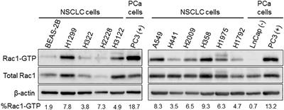 Rac-GEF/Rac Signaling and Metastatic Dissemination in Lung Cancer